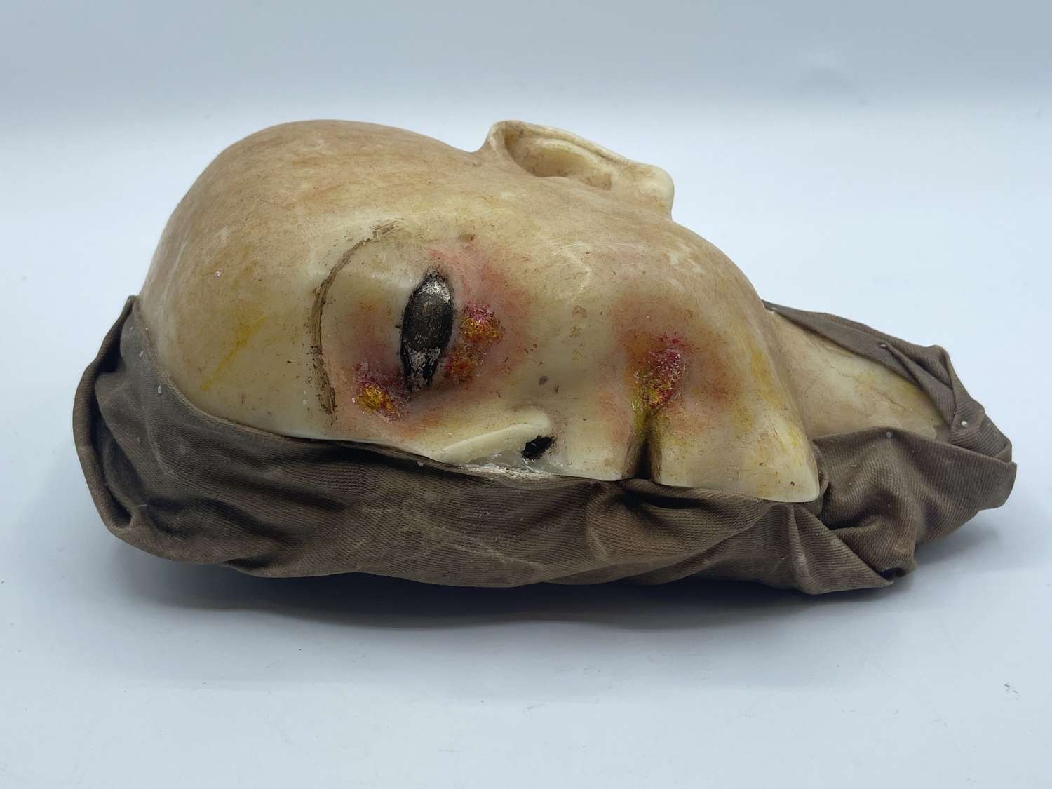 Antique 1890s Paediatric Child Wax Moulage With Syphilis Death Mask