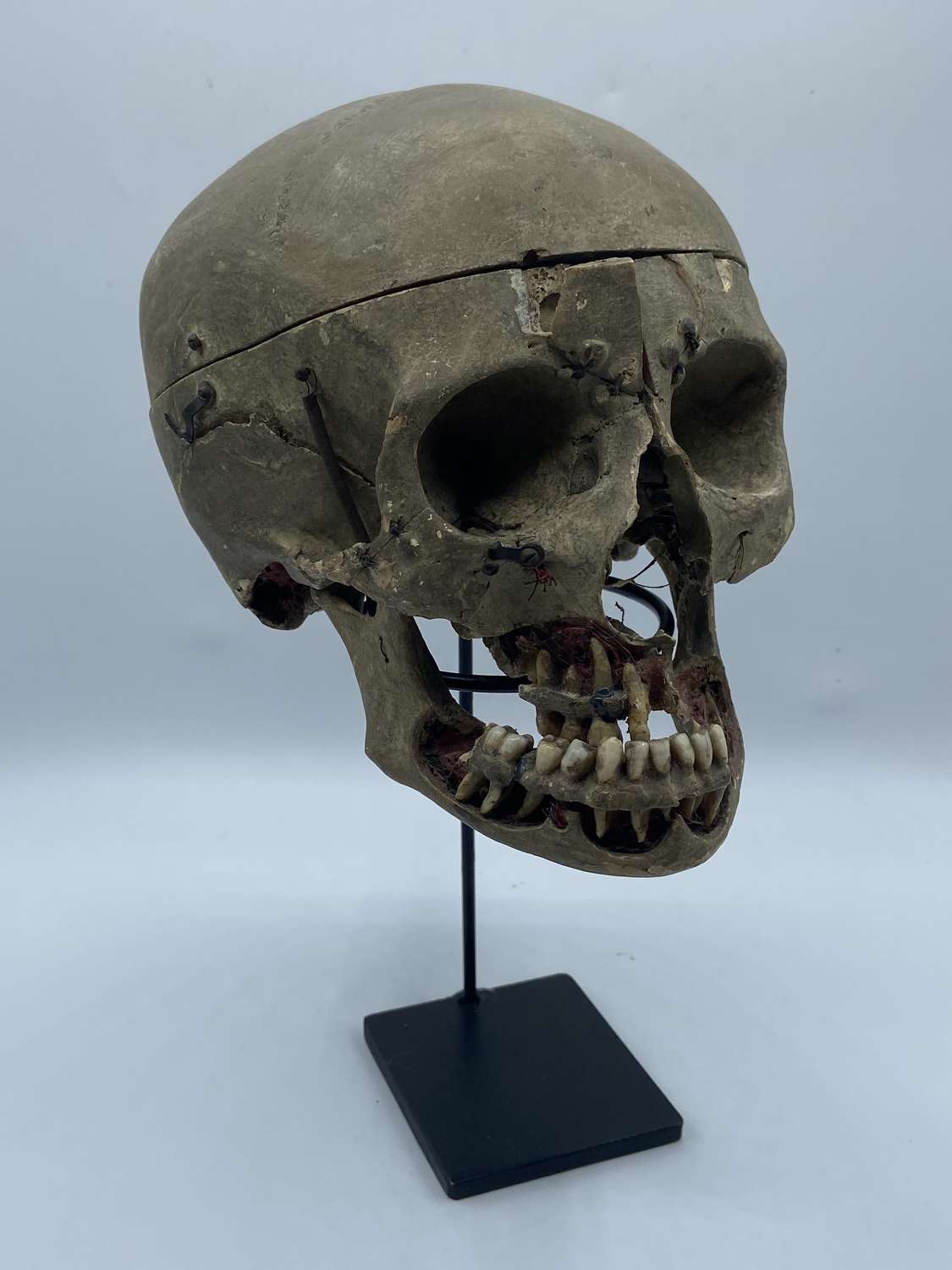 Antique 19th Century Medical 11 Part Demonstration Human Skull