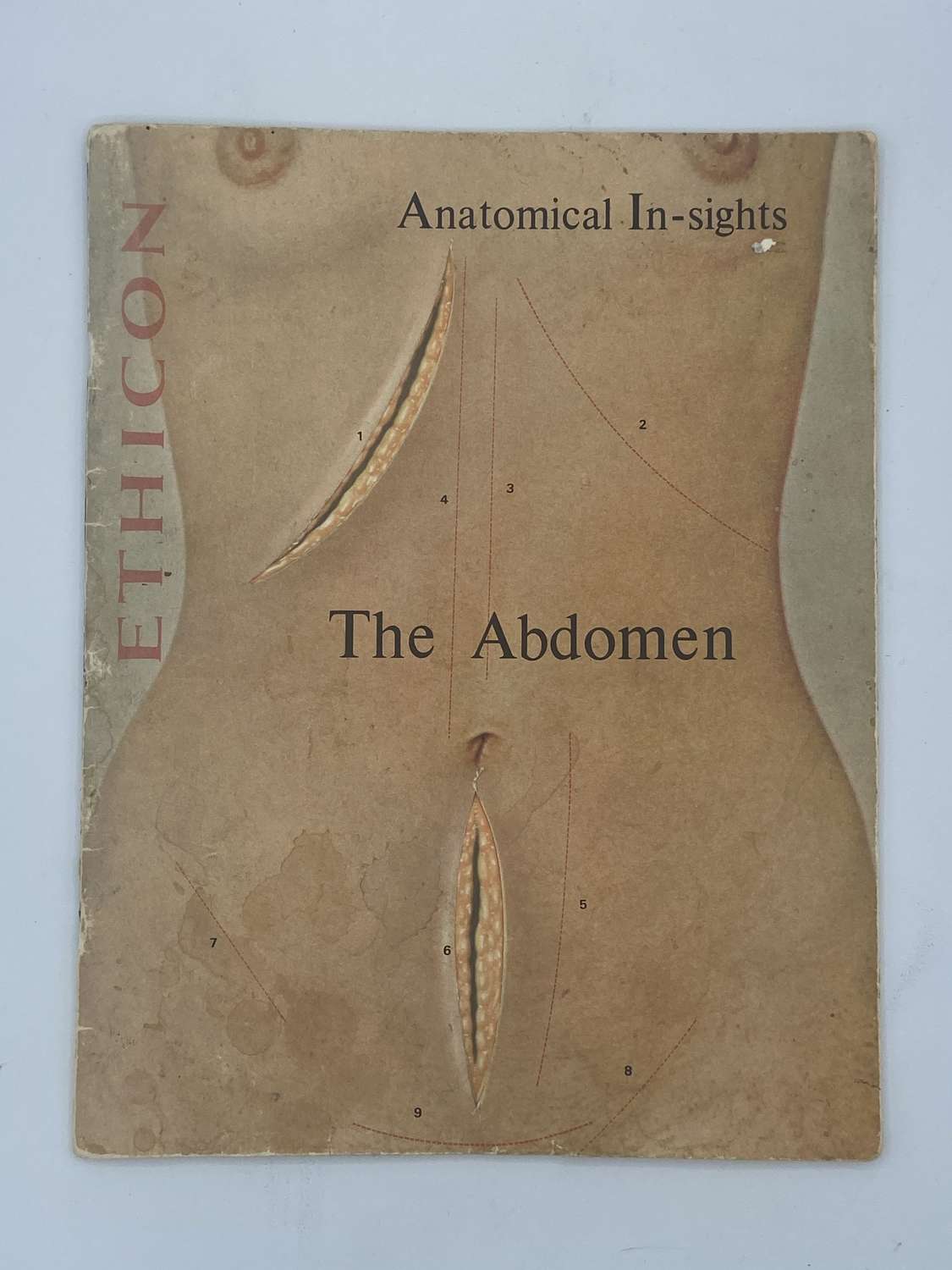 1969 Ethicon Anatomical In-sights: The Abdomen Book