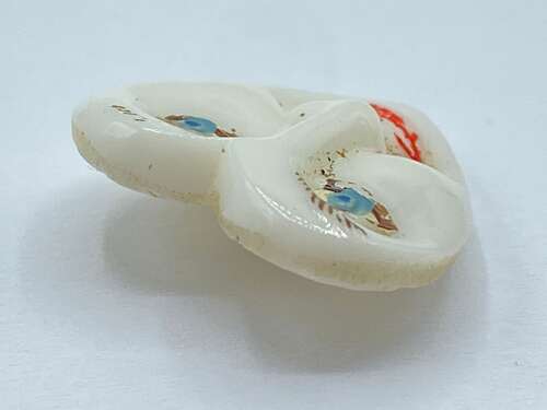 Beautiful Antique Milk Glass Human Face Button Glows Under UV